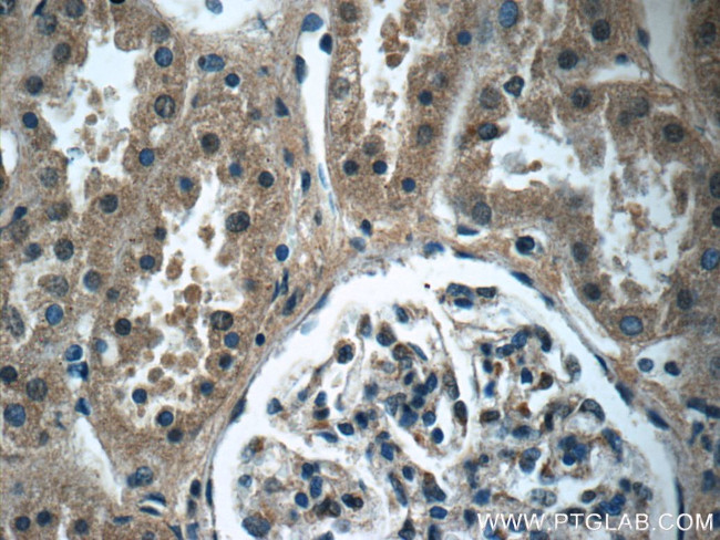 LZTS2 Antibody in Immunohistochemistry (Paraffin) (IHC (P))