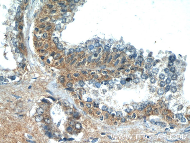 LZTS2 Antibody in Immunohistochemistry (Paraffin) (IHC (P))