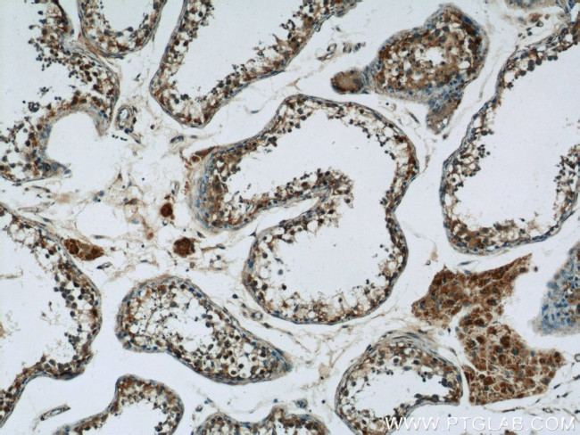 CDC45L Antibody in Immunohistochemistry (Paraffin) (IHC (P))