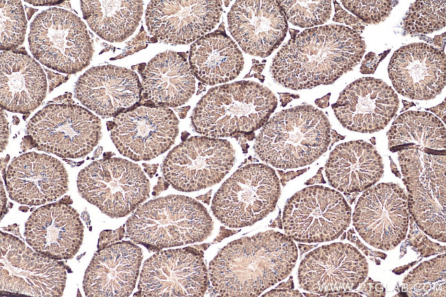 CDC45L Antibody in Immunohistochemistry (Paraffin) (IHC (P))