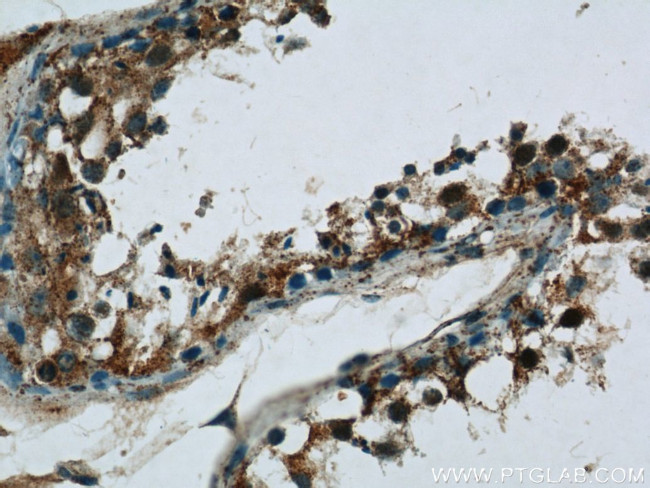 CDC45L Antibody in Immunohistochemistry (Paraffin) (IHC (P))