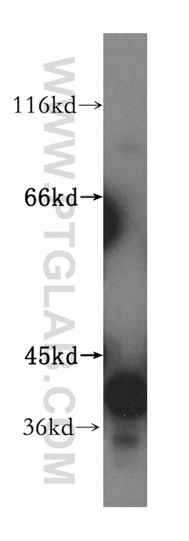 GMPR 1/2 Antibody in Western Blot (WB)