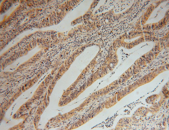 GMPR 1/2 Antibody in Immunohistochemistry (Paraffin) (IHC (P))