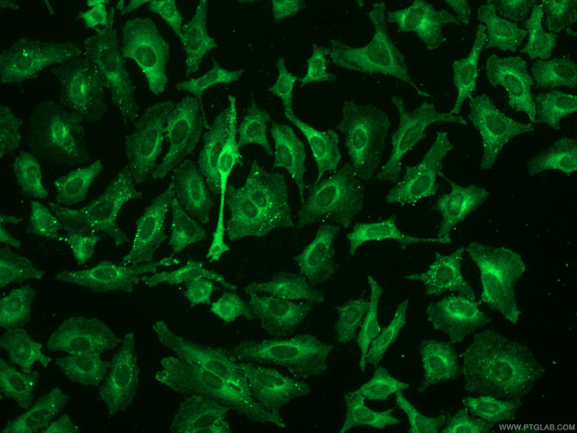 AP2B1 Antibody in Immunocytochemistry (ICC/IF)