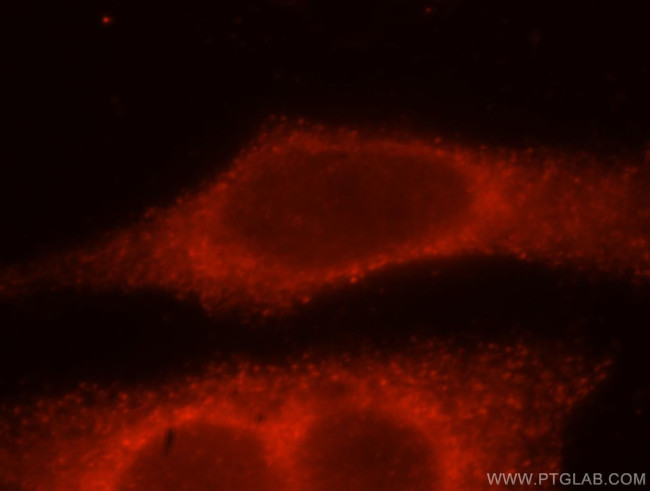 AP2B1 Antibody in Immunocytochemistry (ICC/IF)