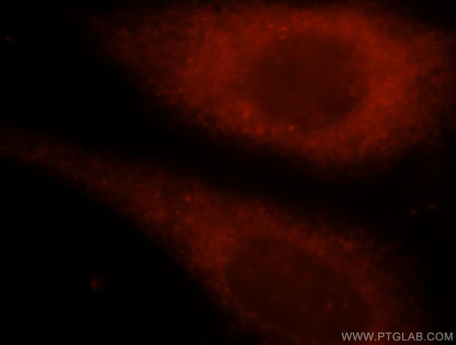 TK1 Antibody in Immunocytochemistry (ICC/IF)