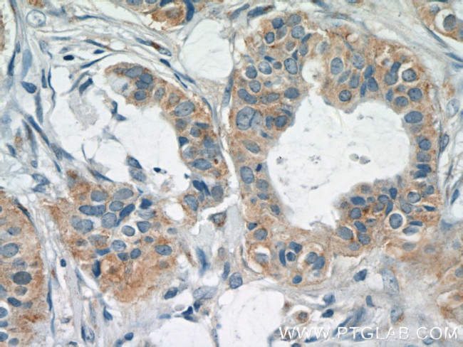 TK1 Antibody in Immunohistochemistry (Paraffin) (IHC (P))