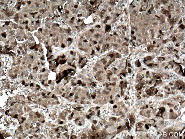 TK1 Antibody in Immunohistochemistry (Paraffin) (IHC (P))