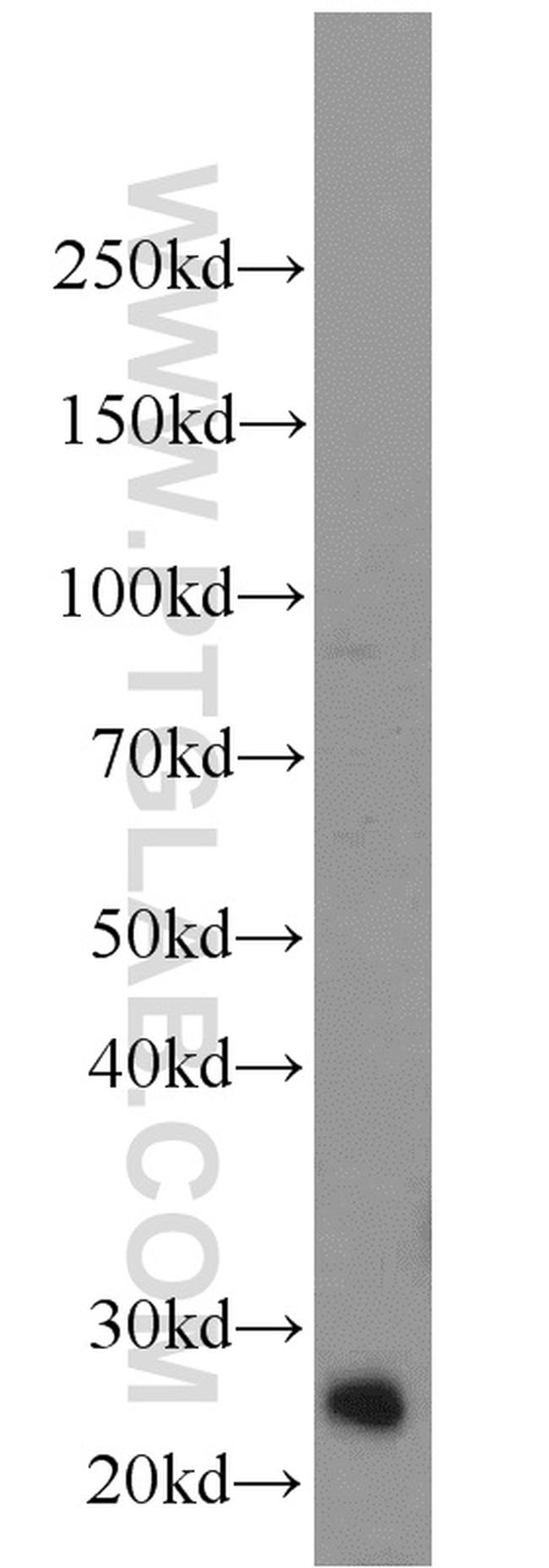 TK1 Antibody in Western Blot (WB)