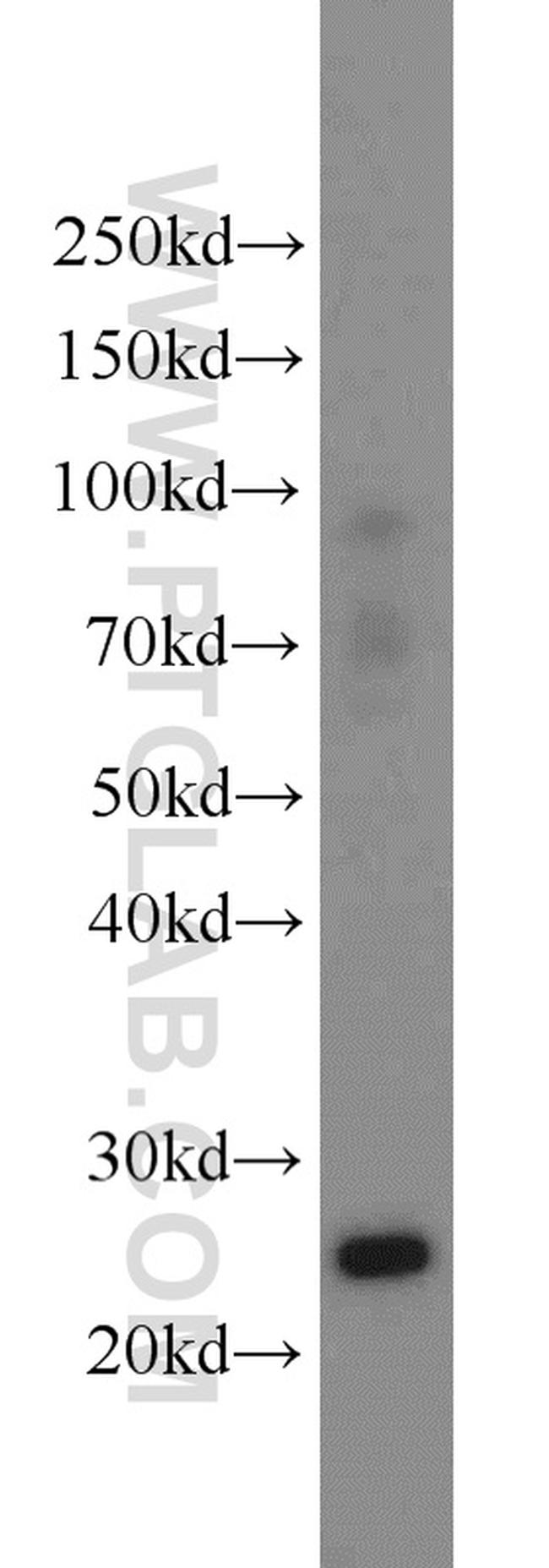 TK1 Antibody in Western Blot (WB)