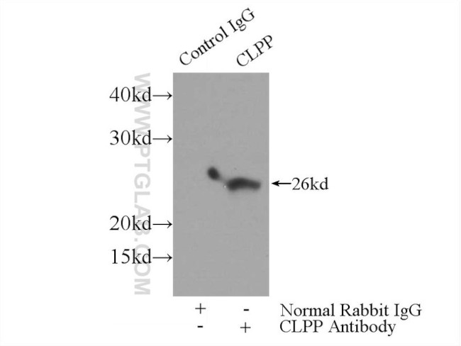 CLPP Antibody in Immunoprecipitation (IP)