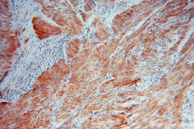 HSPB7 Antibody in Immunohistochemistry (Paraffin) (IHC (P))