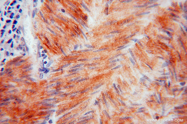 HSPB7 Antibody in Immunohistochemistry (Paraffin) (IHC (P))