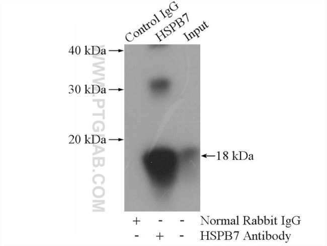 HSPB7 Antibody in Immunoprecipitation (IP)