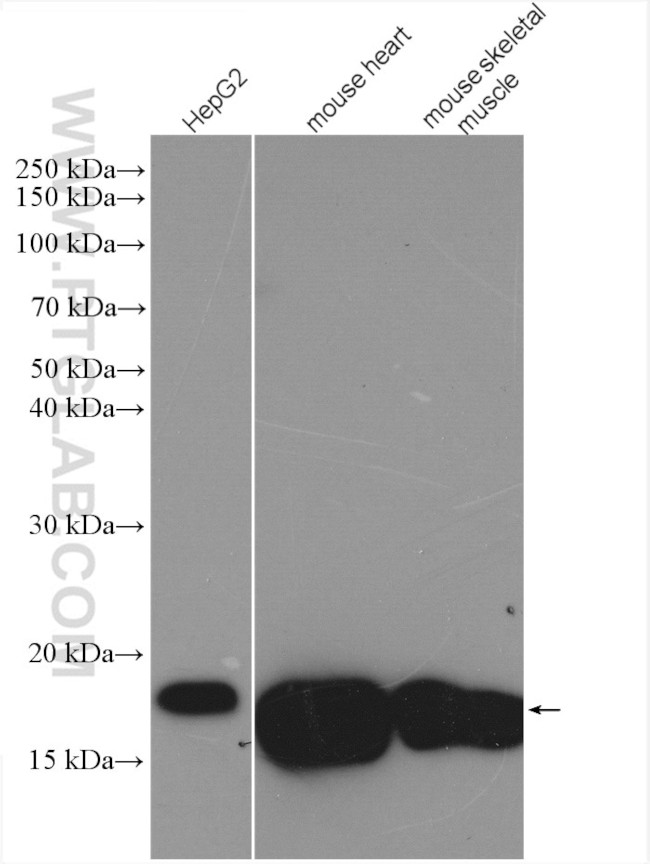 HSPB7 Antibody in Western Blot (WB)