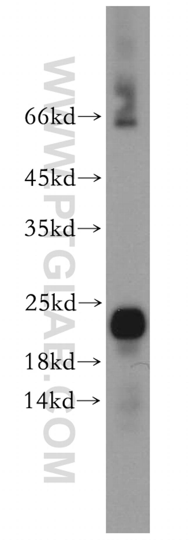 HSPB7 Antibody in Western Blot (WB)