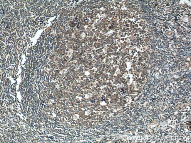 PIP5K1A Antibody in Immunohistochemistry (Paraffin) (IHC (P))