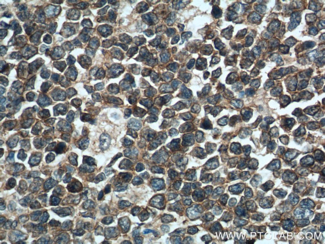 PIP5K1A Antibody in Immunohistochemistry (Paraffin) (IHC (P))