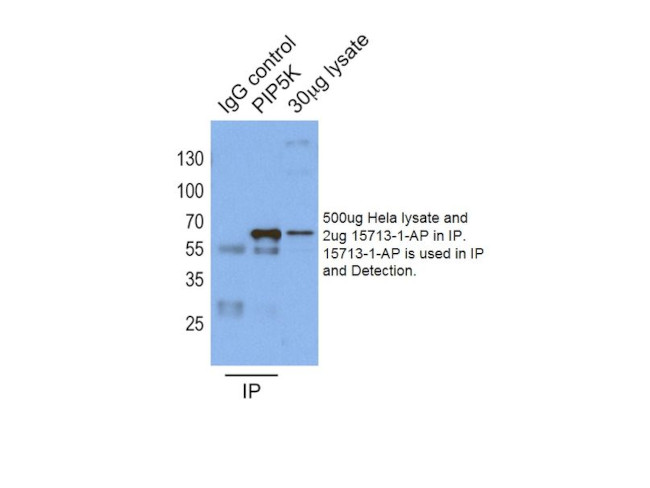 PIP5K1A Antibody in Immunoprecipitation (IP)