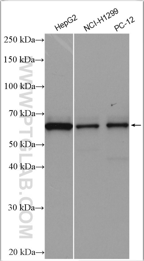 PIP5K1A Antibody in Western Blot (WB)