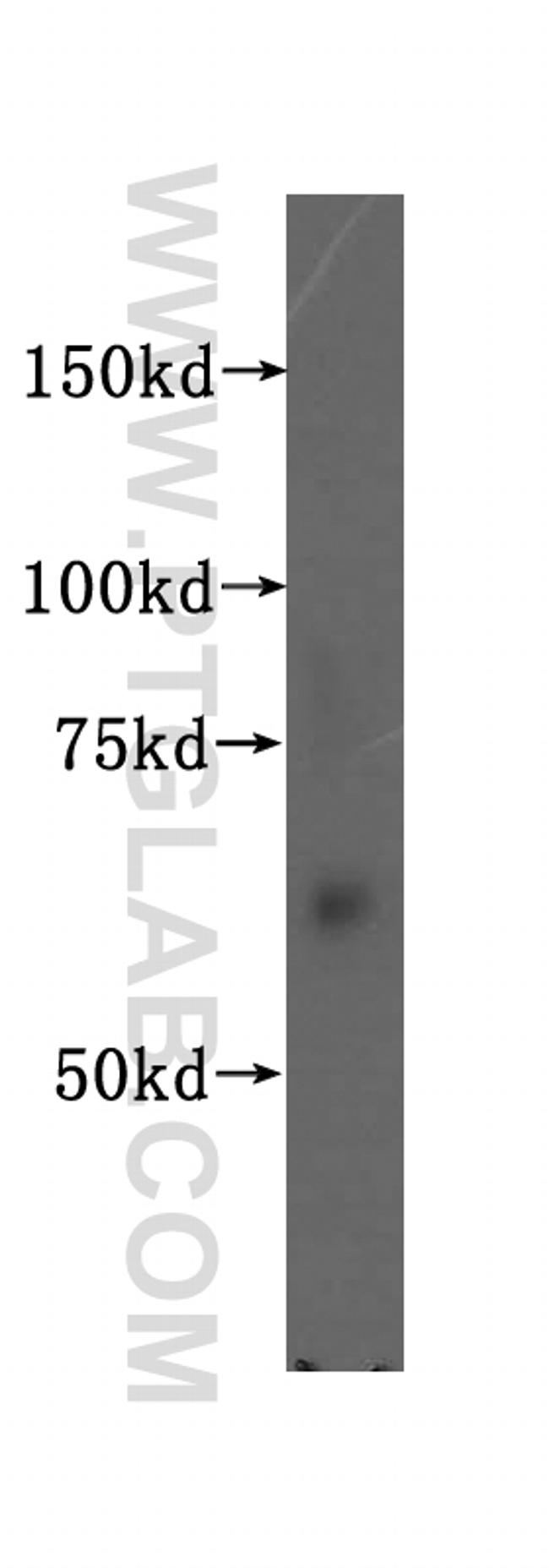 PIP5K1A Antibody in Western Blot (WB)