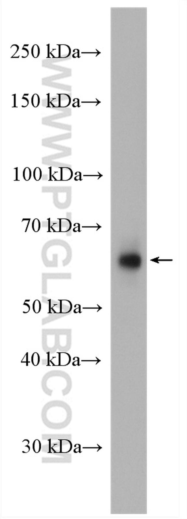 PIP5K1A Antibody in Western Blot (WB)