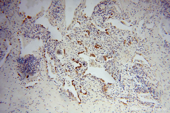 FMO2 Antibody in Immunohistochemistry (Paraffin) (IHC (P))