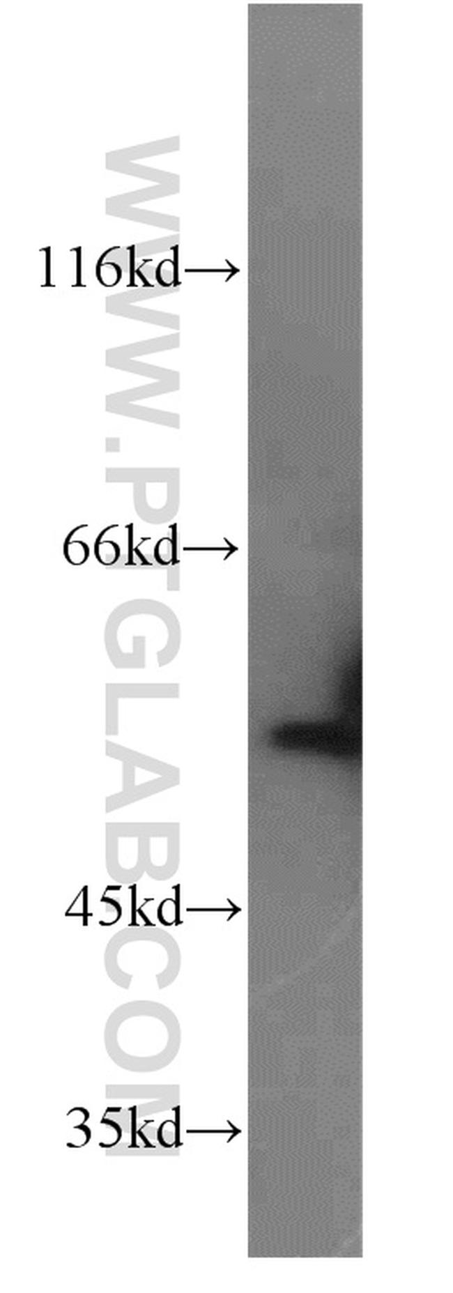 FMO2 Antibody in Western Blot (WB)