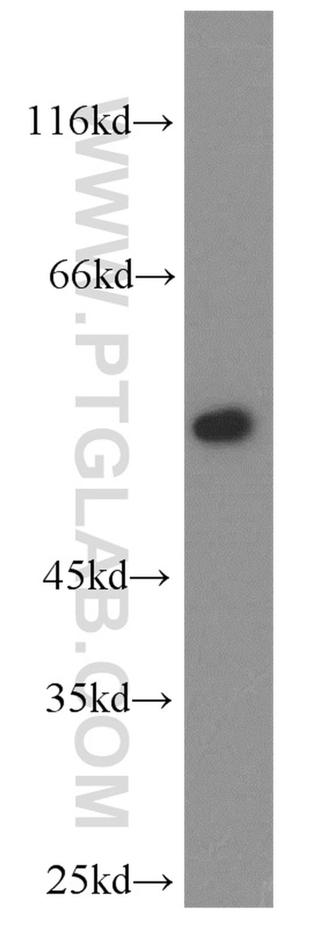 FMO2 Antibody in Western Blot (WB)