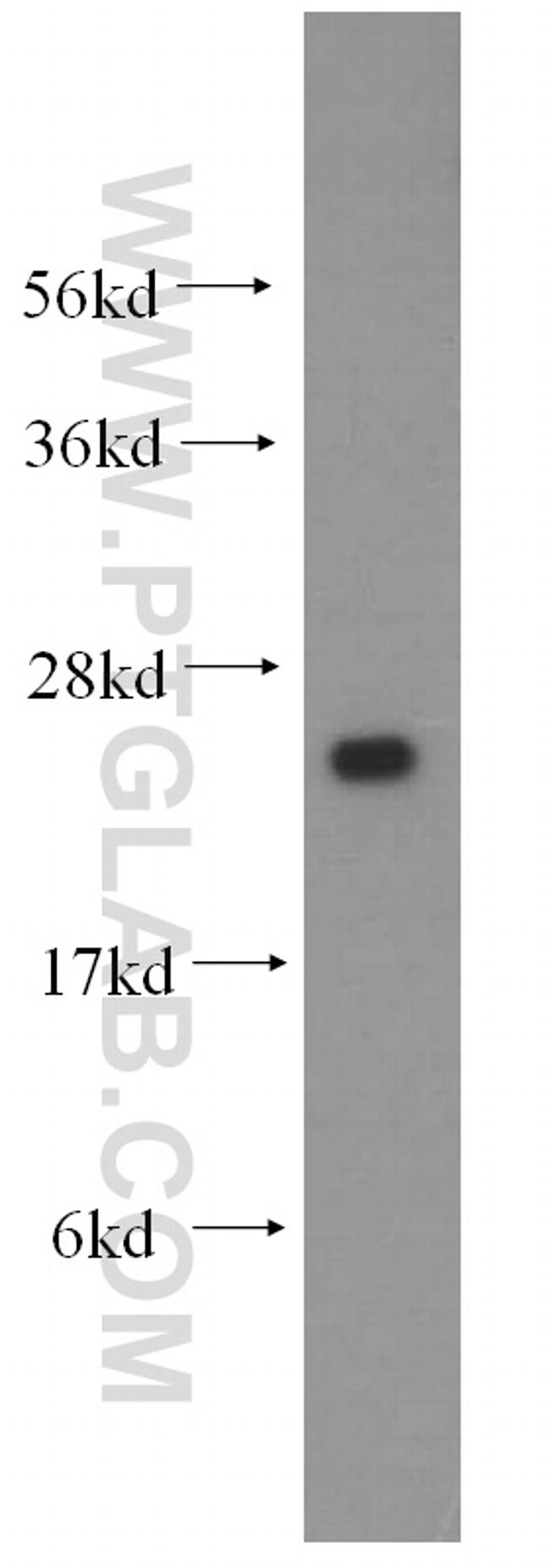 IFT25 Antibody in Western Blot (WB)