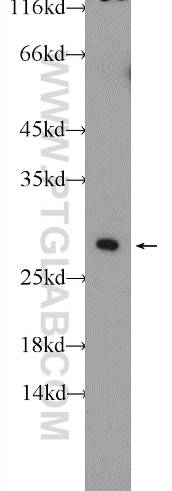 IFT25 Antibody in Western Blot (WB)