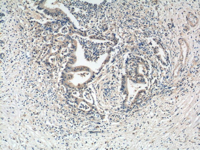 MIA Antibody in Immunohistochemistry (Paraffin) (IHC (P))