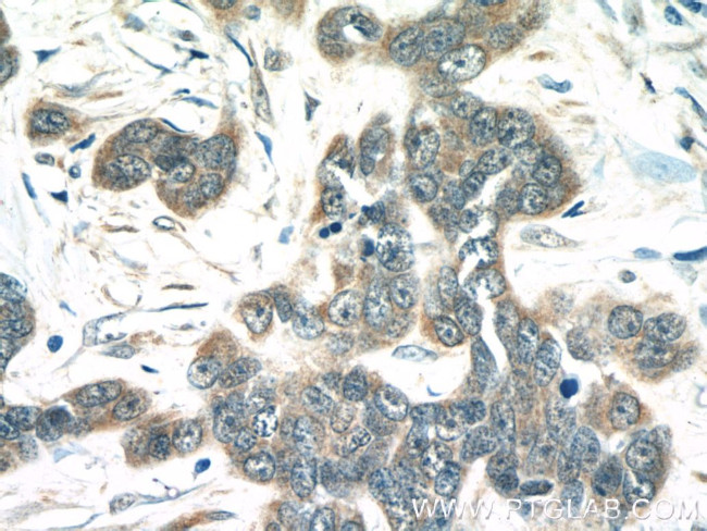 MIA Antibody in Immunohistochemistry (Paraffin) (IHC (P))