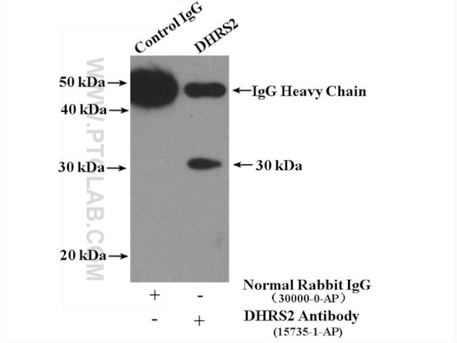 DHRS2 Antibody in Immunoprecipitation (IP)