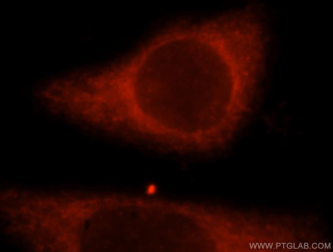 TRIM14 Antibody in Immunocytochemistry (ICC/IF)