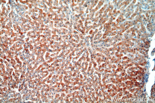 TRIM14 Antibody in Immunohistochemistry (Paraffin) (IHC (P))