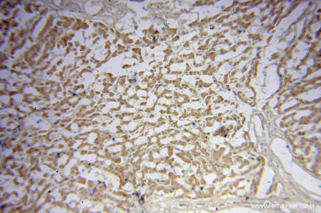 TRIM14 Antibody in Immunohistochemistry (Paraffin) (IHC (P))