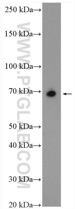 SLC7A4 Antibody in Western Blot (WB)