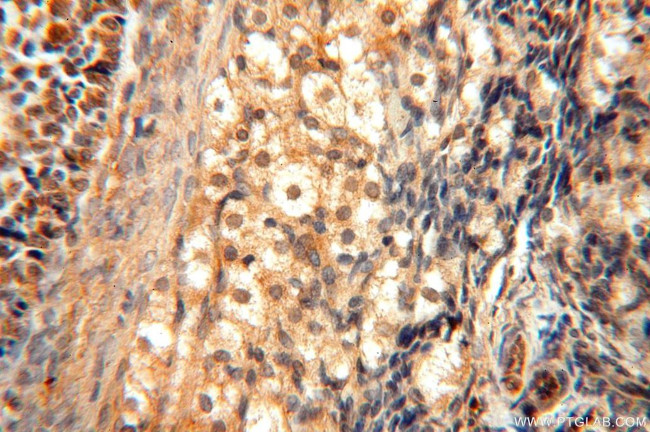 TRBP Antibody in Immunohistochemistry (Paraffin) (IHC (P))