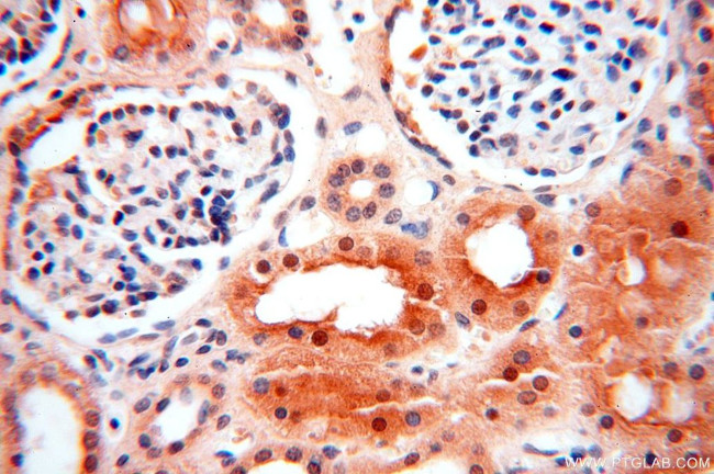 TRBP Antibody in Immunohistochemistry (Paraffin) (IHC (P))