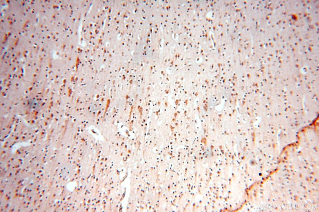 TRBP Antibody in Immunohistochemistry (Paraffin) (IHC (P))