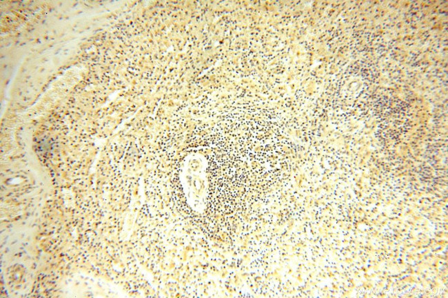 TRBP Antibody in Immunohistochemistry (Paraffin) (IHC (P))