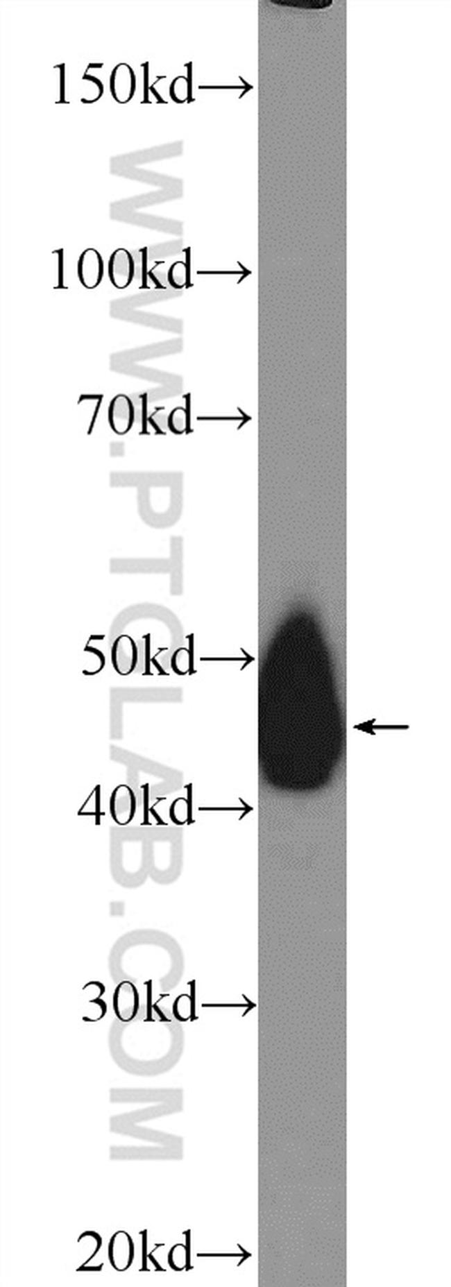 TRBP Antibody in Western Blot (WB)