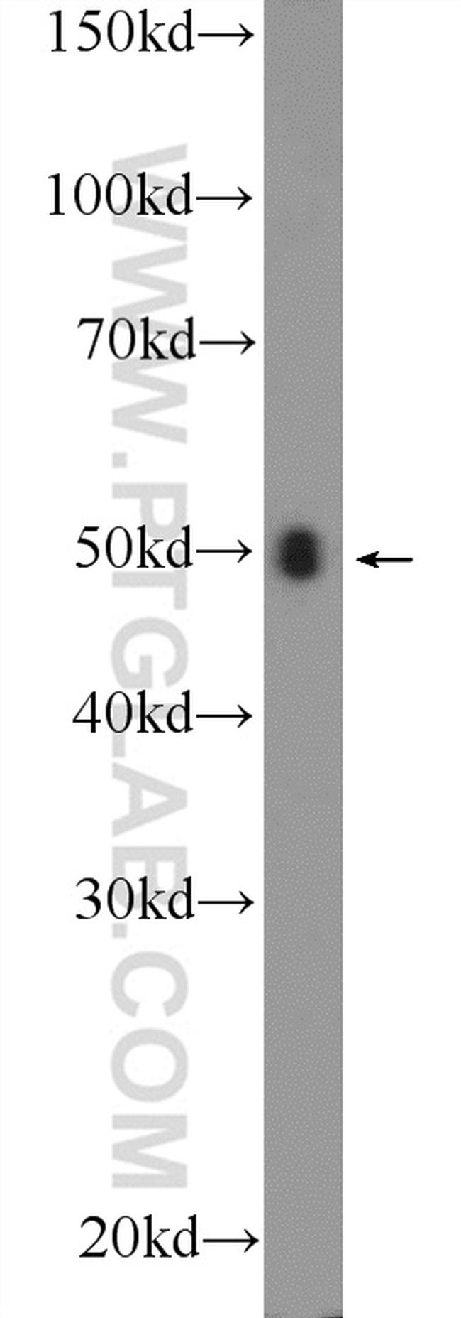 TRBP Antibody in Western Blot (WB)