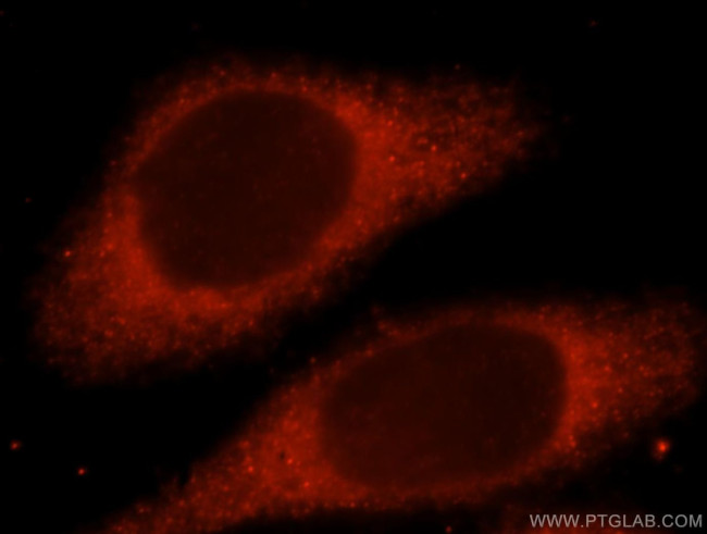 LHPP Antibody in Immunocytochemistry (ICC/IF)