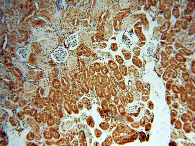 LHPP Antibody in Immunohistochemistry (Paraffin) (IHC (P))