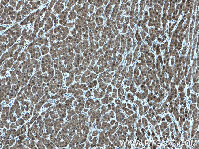 LHPP Antibody in Immunohistochemistry (Paraffin) (IHC (P))