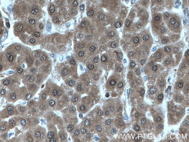 LHPP Antibody in Immunohistochemistry (Paraffin) (IHC (P))