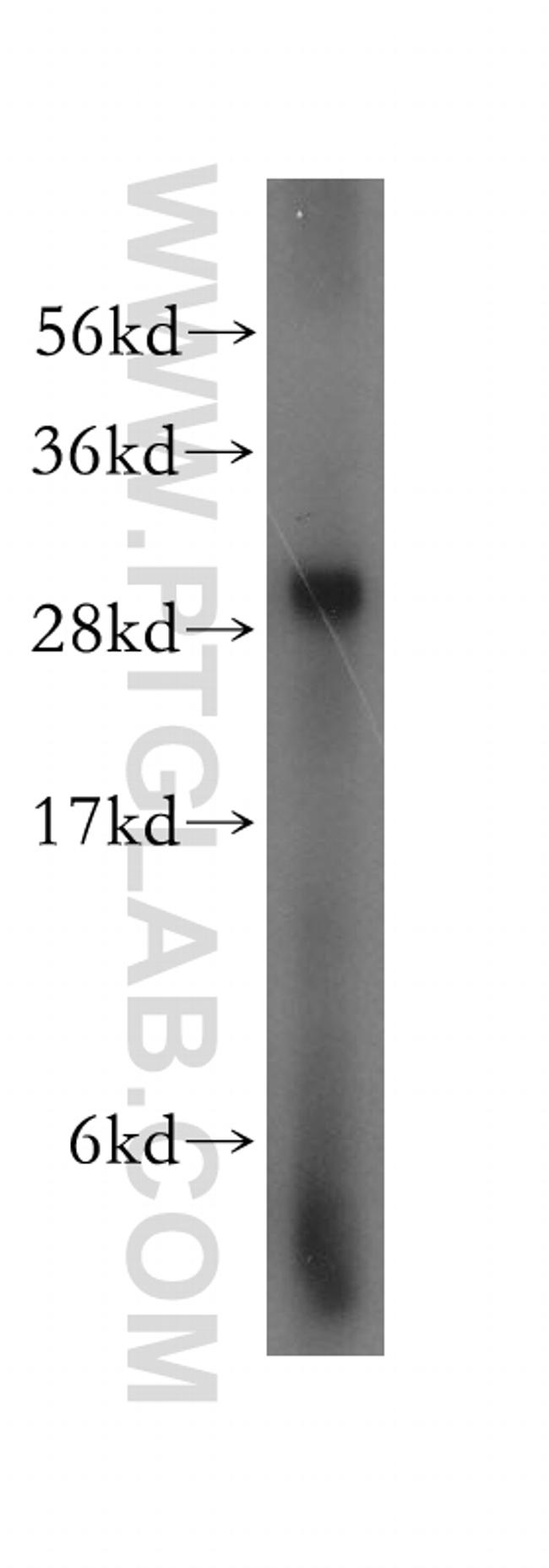 LHPP Antibody in Western Blot (WB)