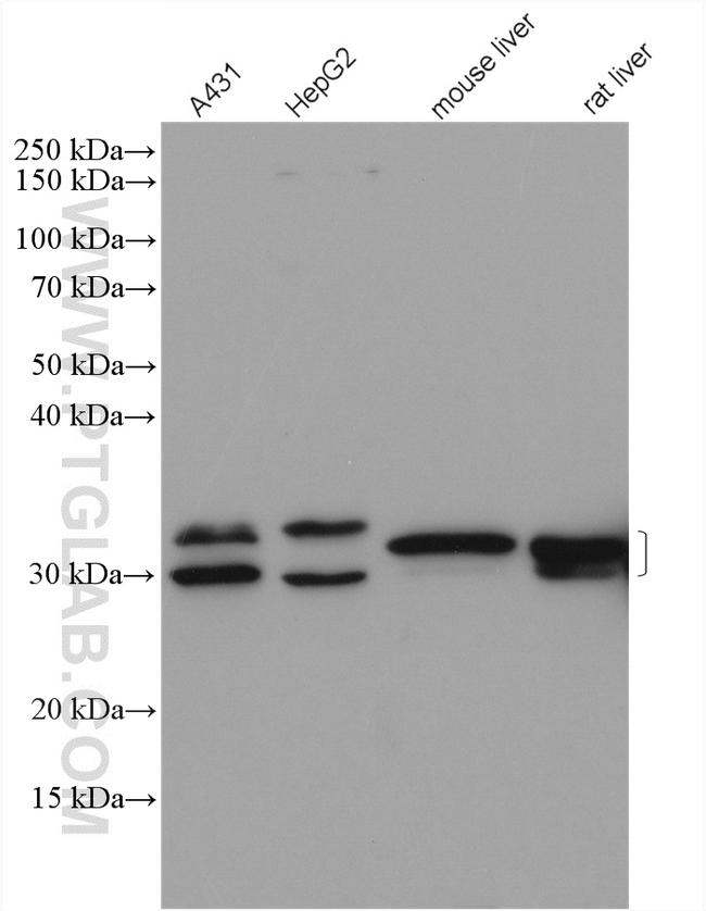 LHPP Antibody in Western Blot (WB)